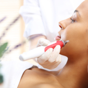 microneedling treatment